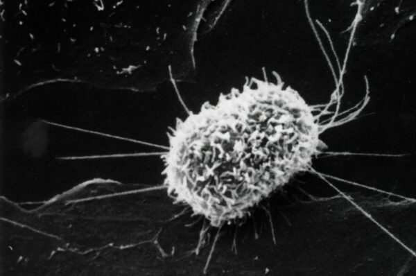 Basics of Cell Biology