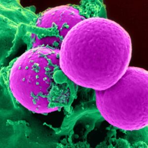 Basics of Immunology