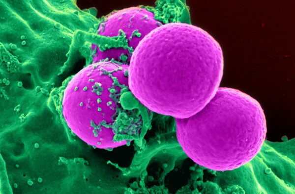 Basics of Immunology